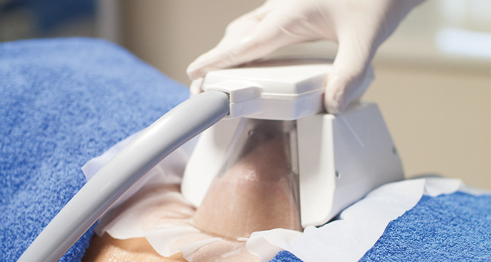 How Fat Freezing and HIFU Work Together? 2 Multiple Areas in One Session HIFU and Fat Freezing Beaconsfield