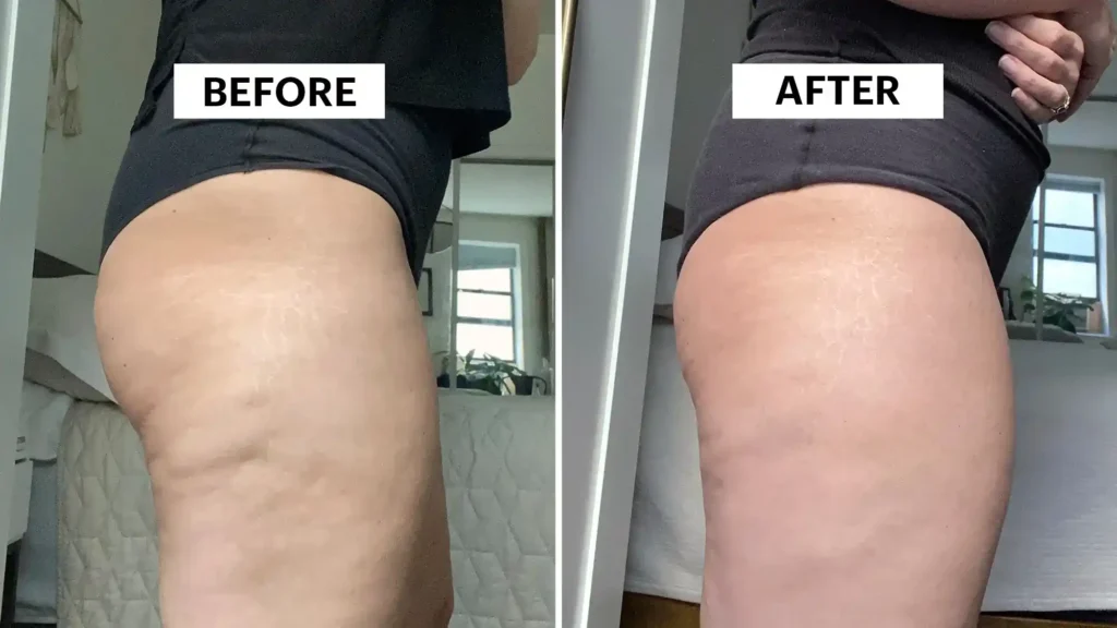 Do Toning Exercise Beaconsfield Really Tackle Cellulite?