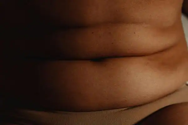 The Hidden Connection: How Stress Shapes Your Fitness and Body Composition 3 image of what stress can do on the stomach area and how Lipo 360 Beaconsfield can help to change your body shape.